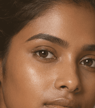 ankita oberoi, patient at MIGAKKI Skin & Hair Clinic