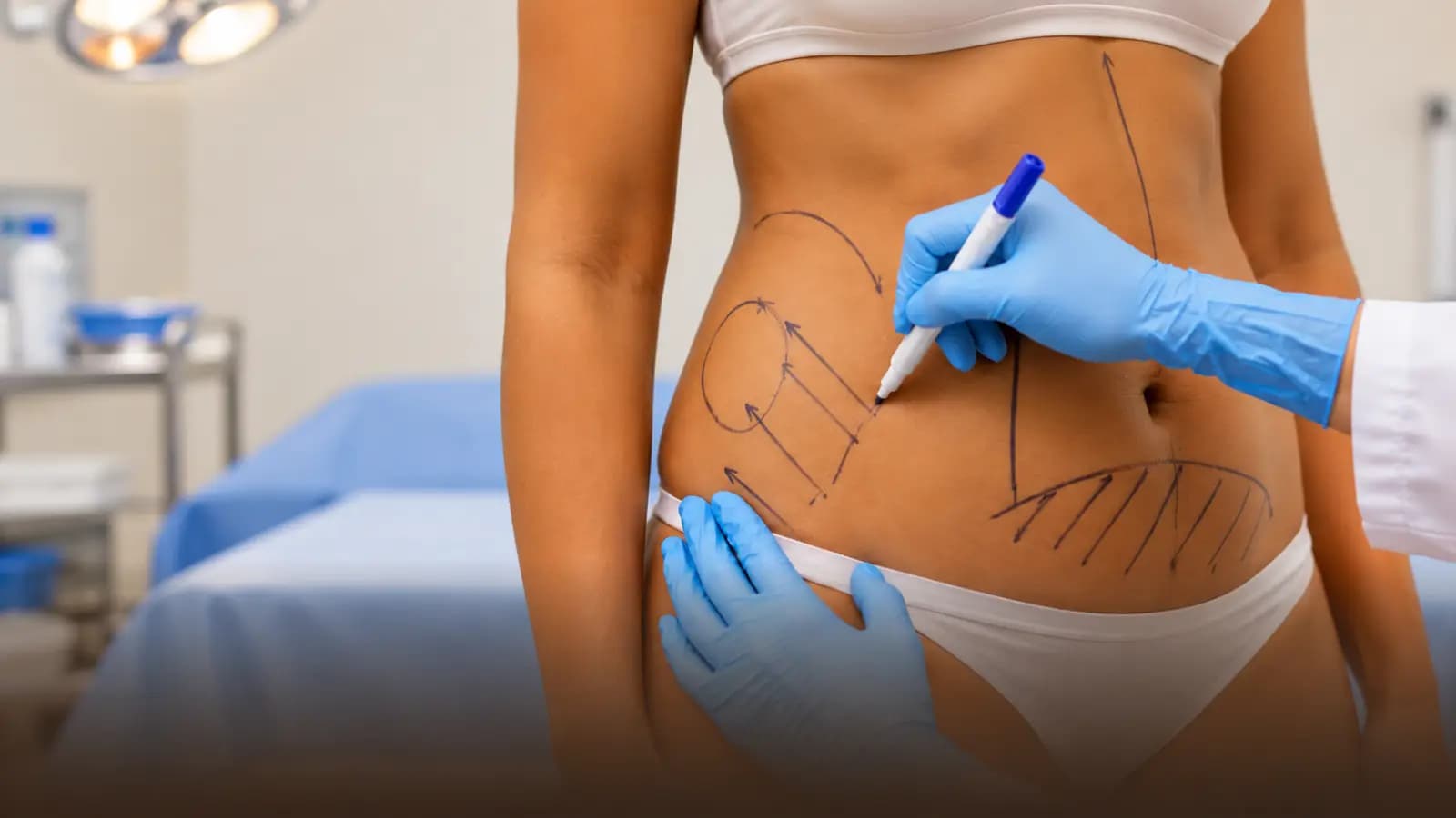Abdominoplasty (Tummy Tuck) at MIGAKKI Skin & Hair Clinic